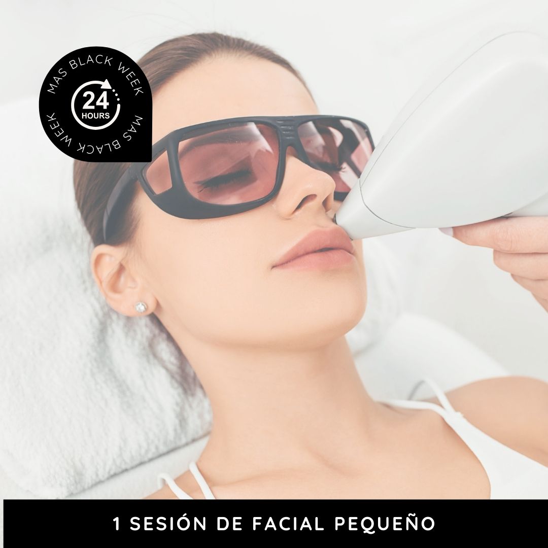 LÁSER 1 sesión de facial pequeño