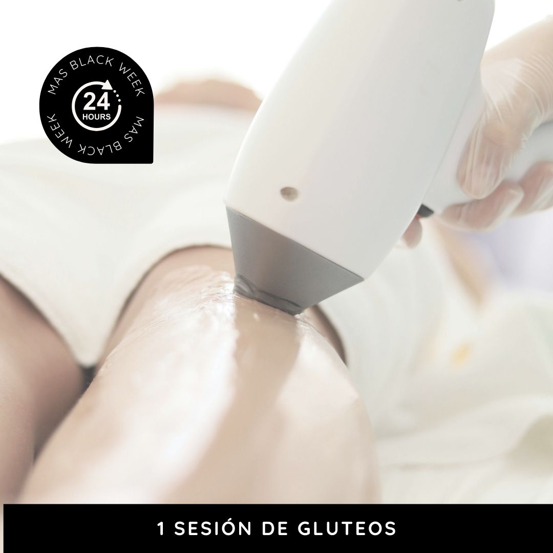 LÁSER 1 sesión de gluteos