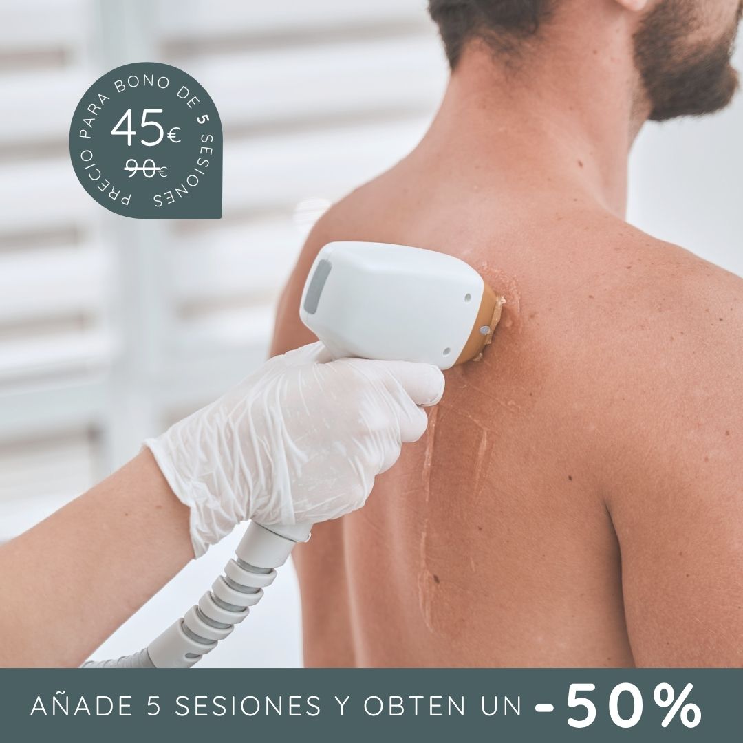 LÁSER 1 sesión de espalda